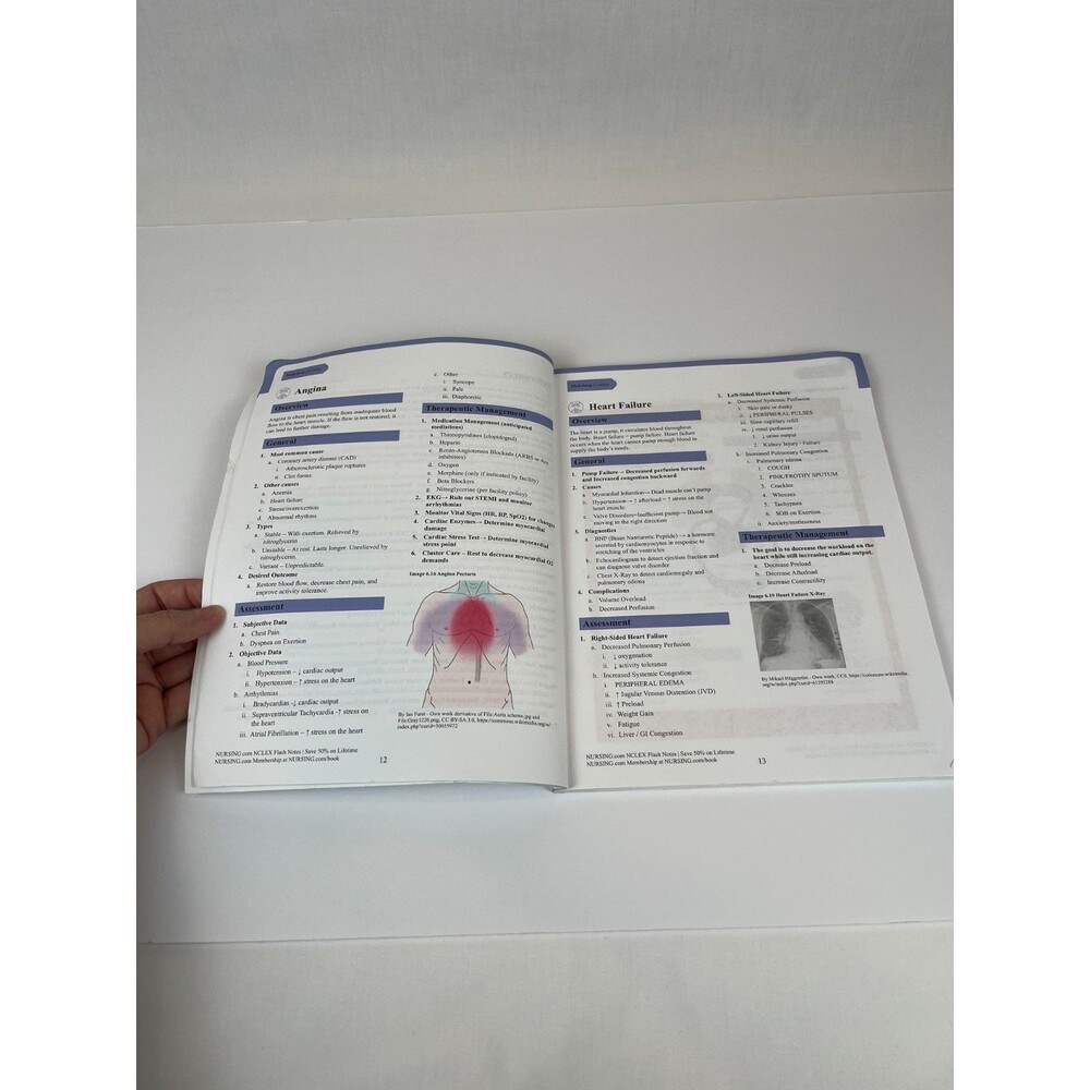 NCLEX Flash Notes: 77 Essential Nursing Topics for NCLEX Success Study Guide - Picture 8 of 16